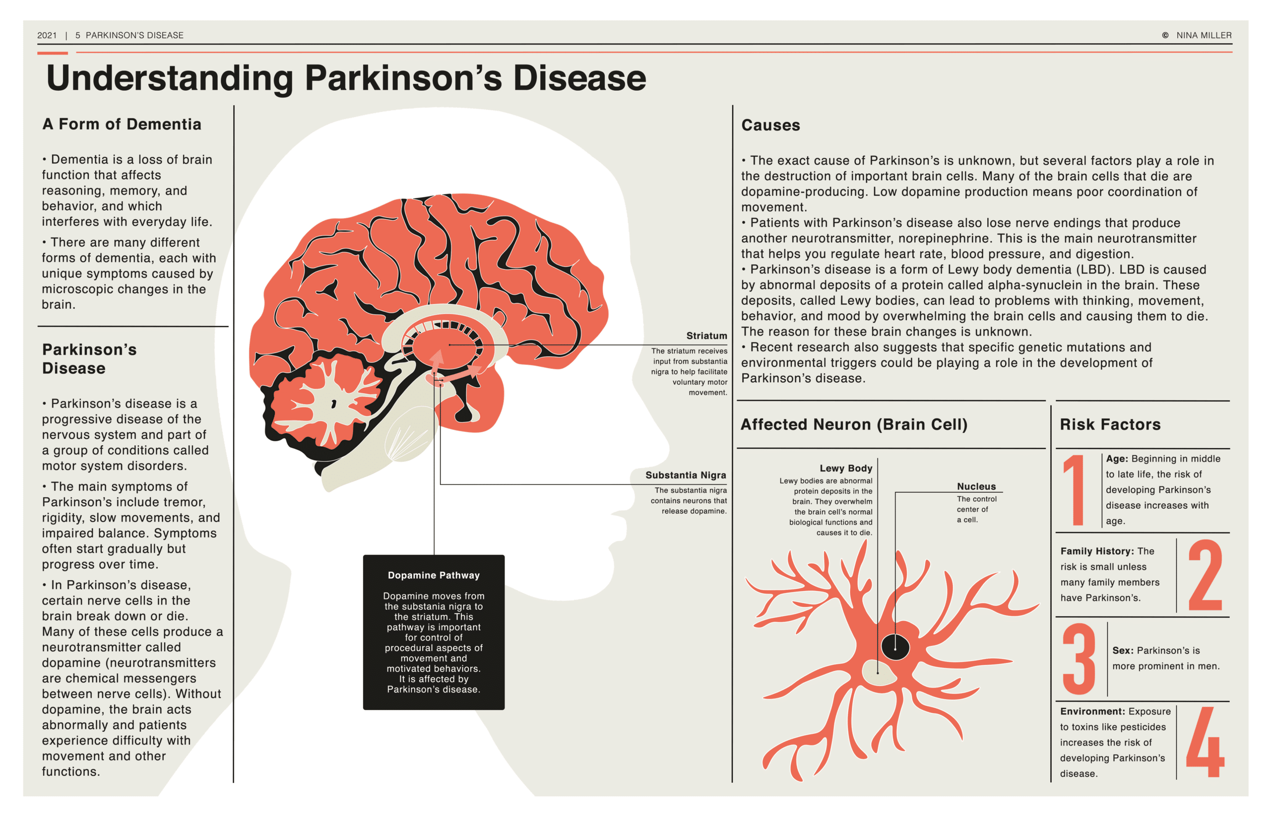 Lewy Body Dementia (LBD): What It Is, Symptoms & Treatment