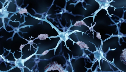 Alzheimer’s disease, Amyloid plaques aggregates